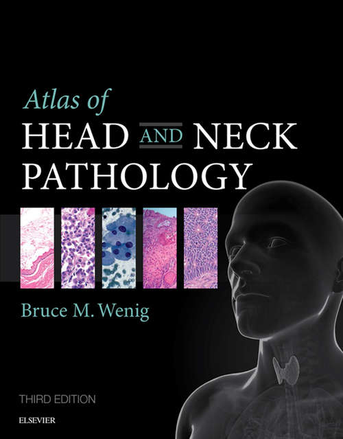 Book cover of Atlas of Head and Neck Pathology E-Book (3) (Atlas of Surgical Pathology)