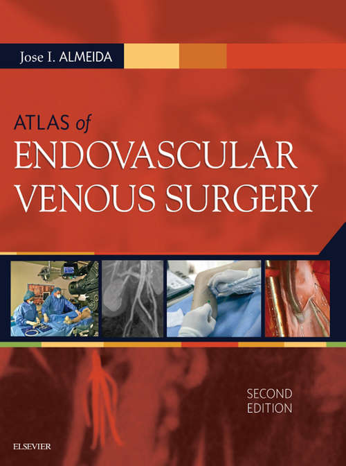 Book cover of Atlas of Endovascular Venous Surgery E-Book