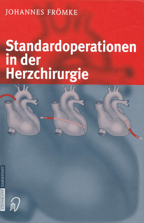 Book cover of Standardoperationen in der Herzchirurgie (2003)
