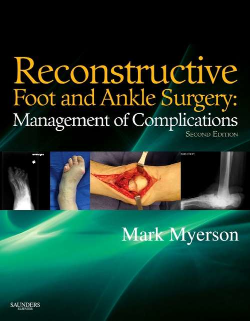Book cover of Reconstructive Foot and Ankle Surgery: Expert Consult (3)