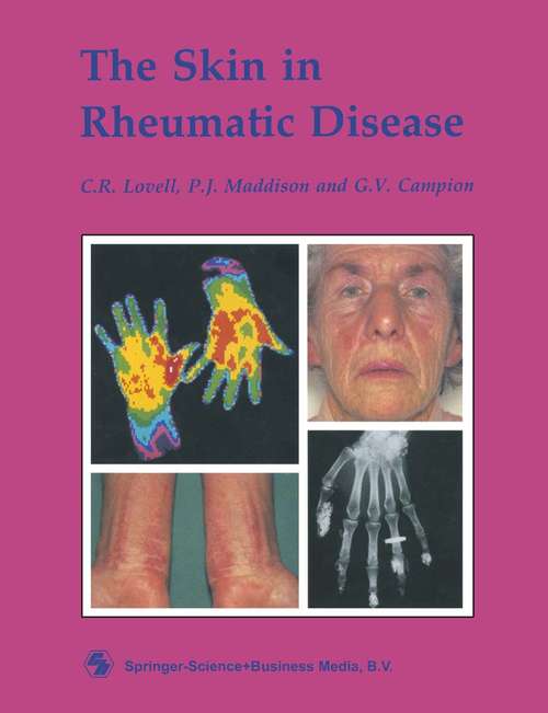 Book cover of The Skin in Rheumatic Disease (1990)