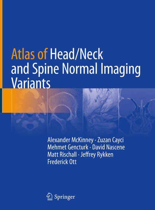 Book cover of Atlas of Head/Neck and Spine Normal Imaging Variants (1st ed. 2018)