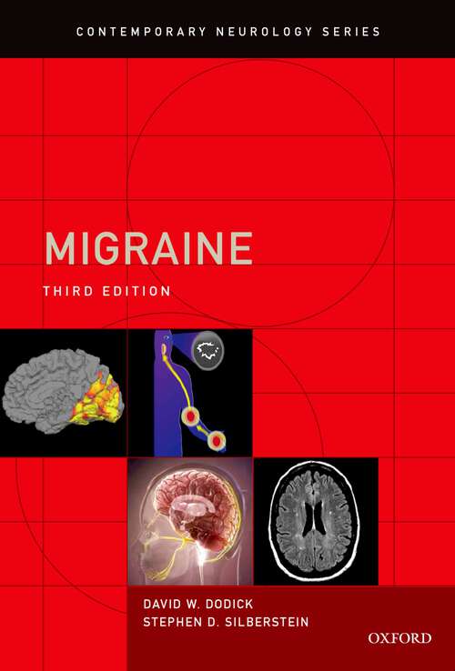 Book cover of Migraine (Contemporary Neurology Series)