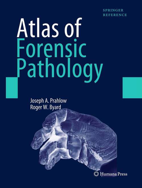 Book cover of Atlas of Forensic Pathology: For Police, Forensic Scientists, Attorneys, And Death Investigators (pdf)