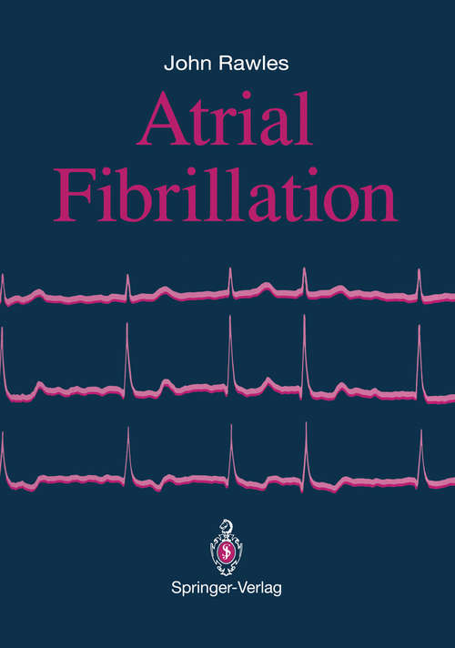 Book cover of Atrial Fibrillation: (pdf) (1992)