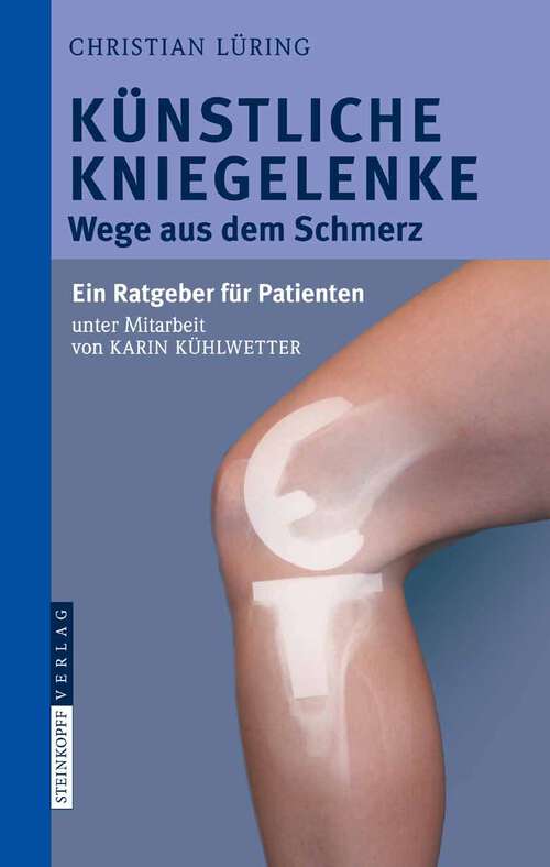 Book cover of Künstliche Kniegelenke: Wege aus dem Schmerz (2008)