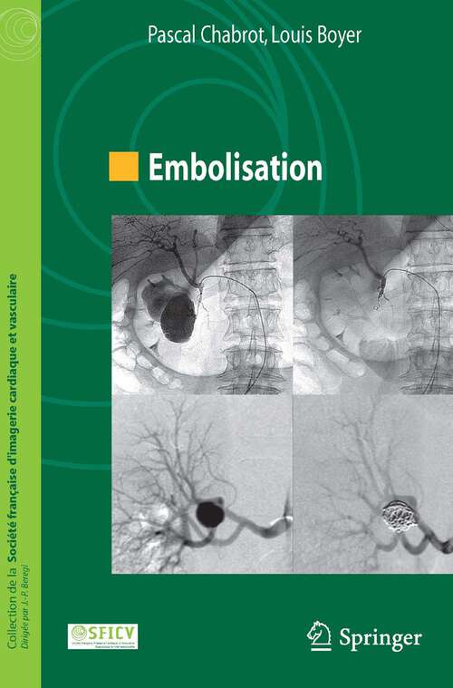 Book cover of Embolisation: (coll. De La Société Française D'imagerie Cardiaque Et Vasculaire) (2012) (Collection de la Société française d’imagerie cardiaque et vasculaire)
