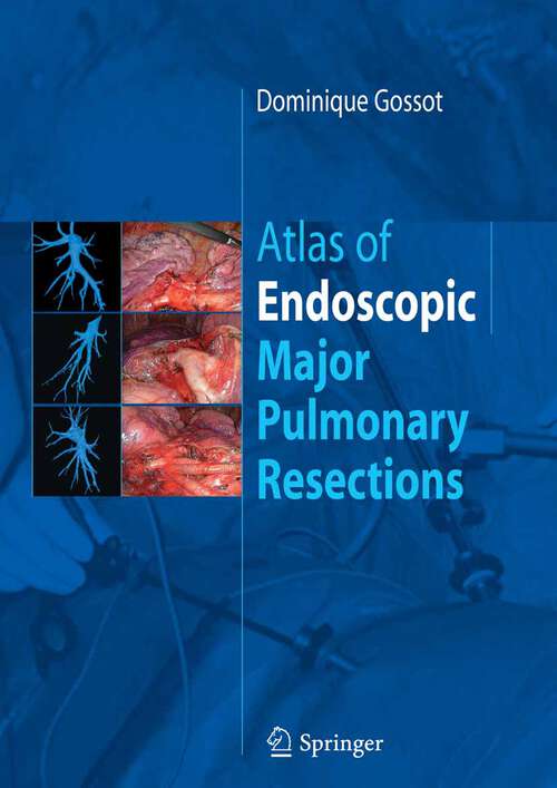 Book cover of Atlas of endoscopic major pulmonary resections (2010)