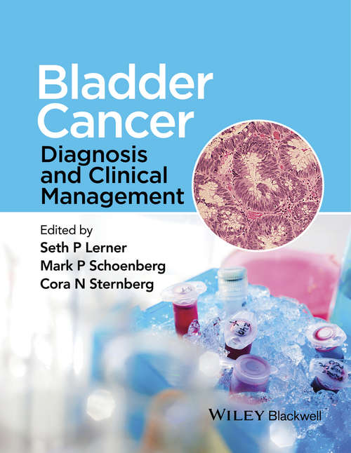Book cover of Bladder Cancer: Diagnosis and Clinical Management