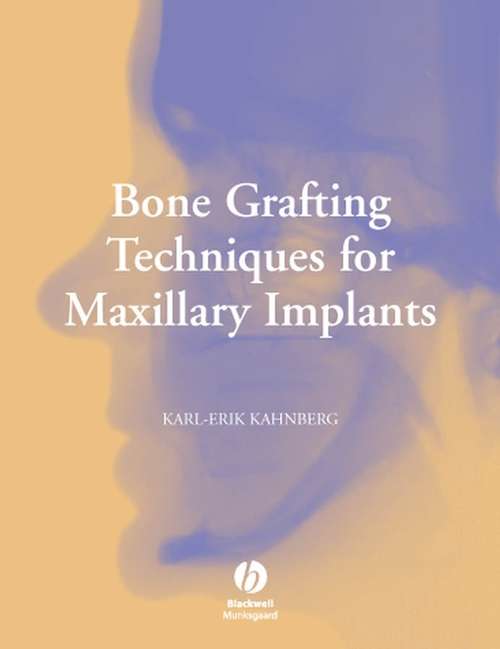 Book cover of Bone Grafting Techniques for Maxillary Implants