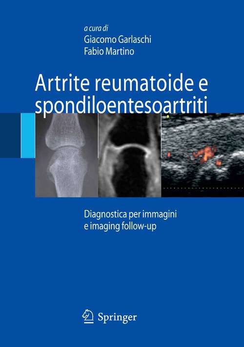 Book cover of Artrite reumatoide e spondiloentesoartriti: Diagnostica per immagini ed imaging follow-up (2007)