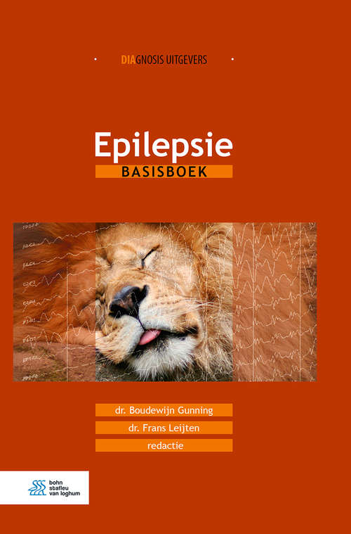 Book cover of Epilepsie: Basisboek