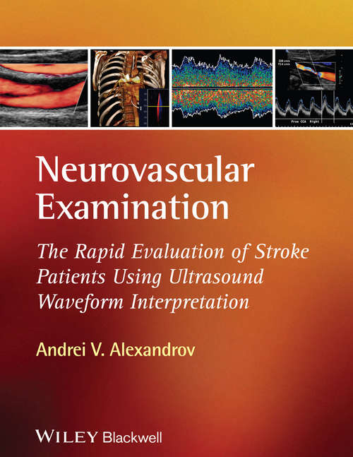 Book cover of Neurovascular Examination: The Rapid Evaluation of Stroke Patients Using Ultrasound Waveform Interpretation