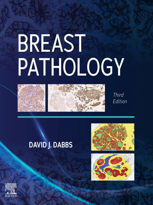 Book cover of Breast Pathology, E-Book