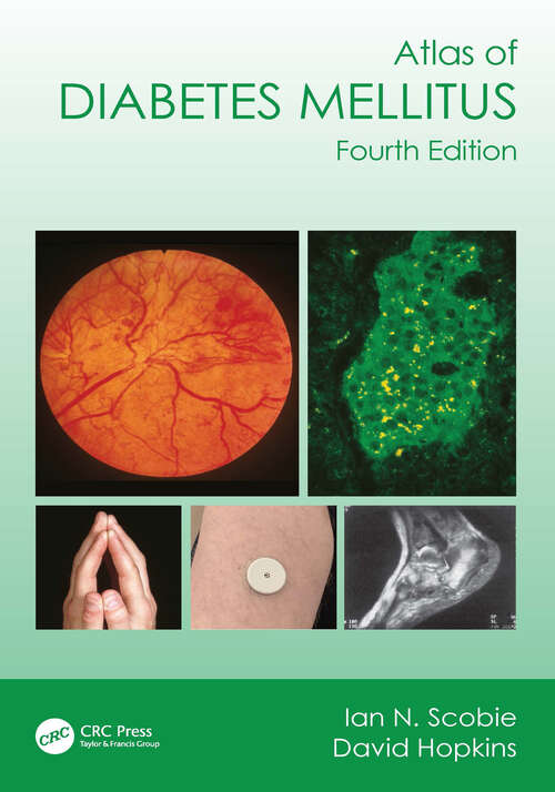 Book cover of Atlas of Diabetes Mellitus (4)