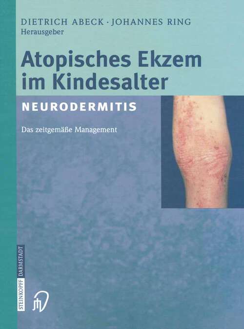Book cover of Atopisches Ekzem im Kindesalter (Neurodermitis): Zeitgemäßes Management (2002)