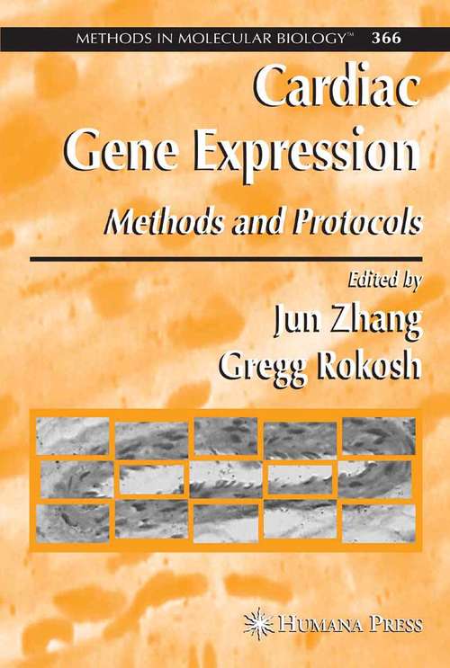 Book cover of Cardiac Gene Expression: Methods and Protocols (2007) (Methods in Molecular Biology #366)