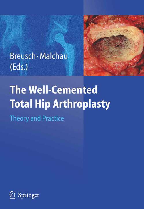 Book cover of The Well-Cemented Total Hip Arthroplasty: Theory and Practice (2005)