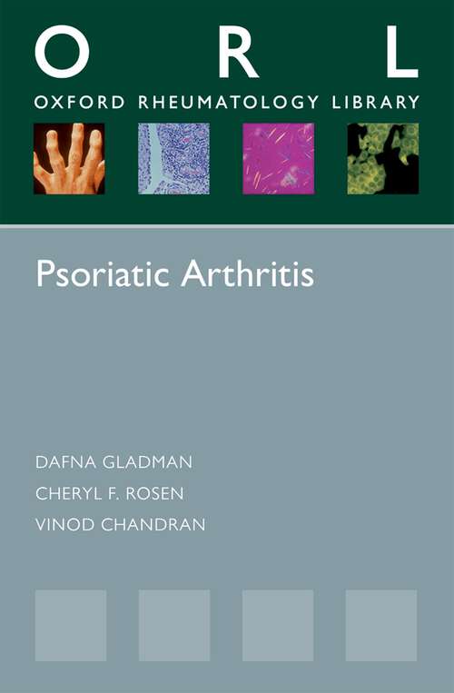 Book cover of Psoriatic Arthritis (Oxford Rheumatology Library)