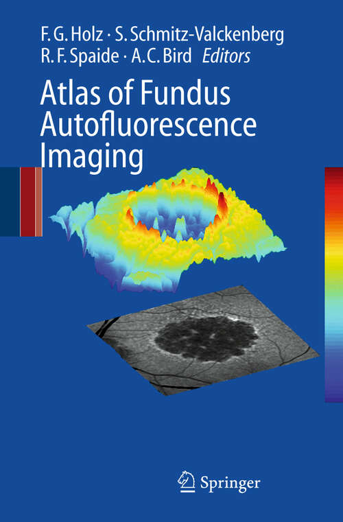 Book cover of Atlas of Fundus Autofluorescence Imaging (2007)