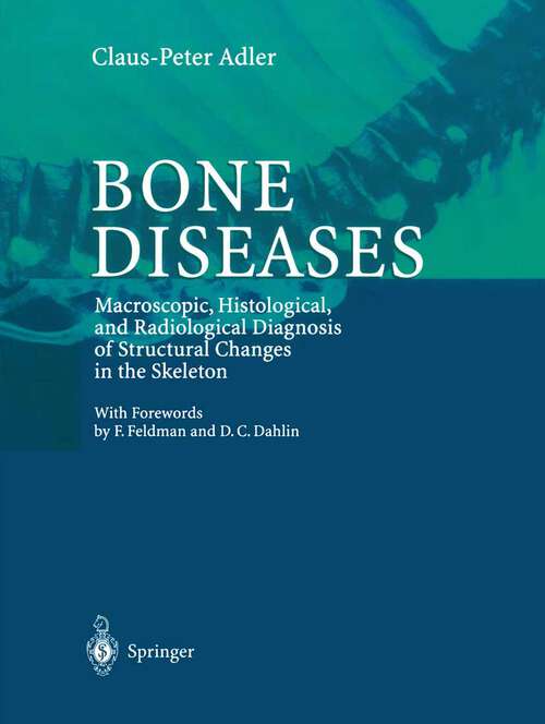 Book cover of Bone Diseases: Macroscopic, Histological, and Radiological Diagnosis of Structural Changes in the Skeleton (2000)
