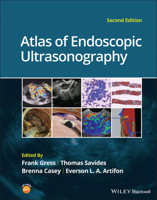 Book cover of Atlas of Endoscopic Ultrasonography (2)