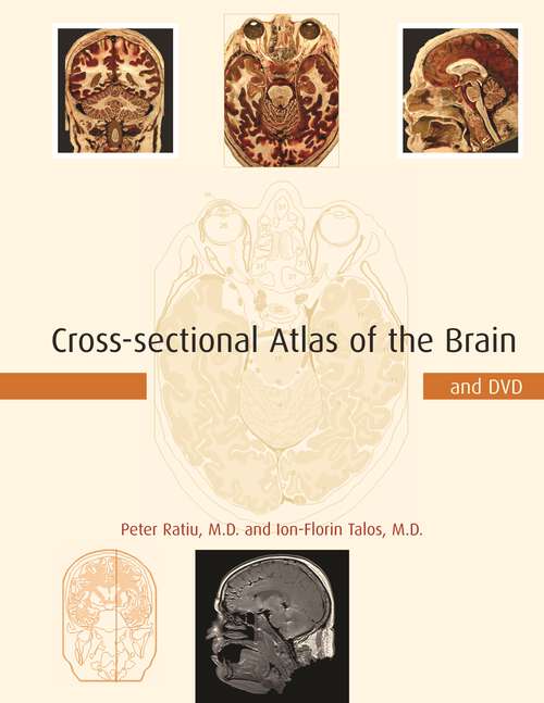 Book cover of Cross-sectional Atlas of the Brain