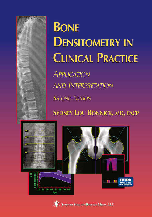 Book cover of Bone Densitometry in Clinical Practice: Application and Interpretation (2nd ed. 2004) (Current Clinical Practice)
