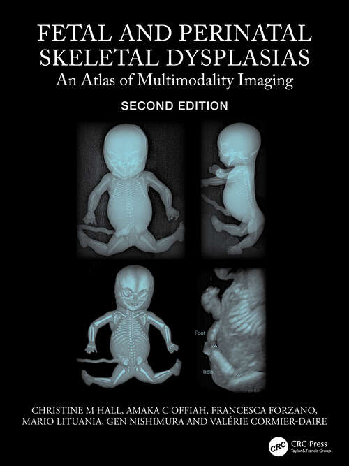 Book cover of Fetal and Perinatal Skeletal Dysplasias: An Atlas of Multimodality Imaging