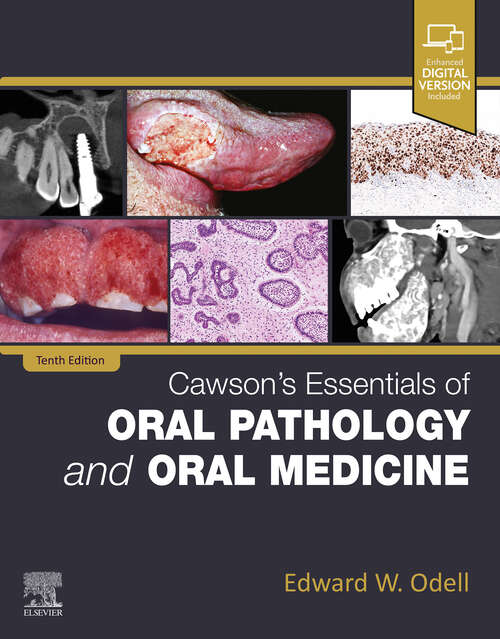 Book cover of Cawson's Essentials of Oral Pathology and Oral Medicine: Cawson's Essentials of Oral Pathology and Oral Medicine - E-Book