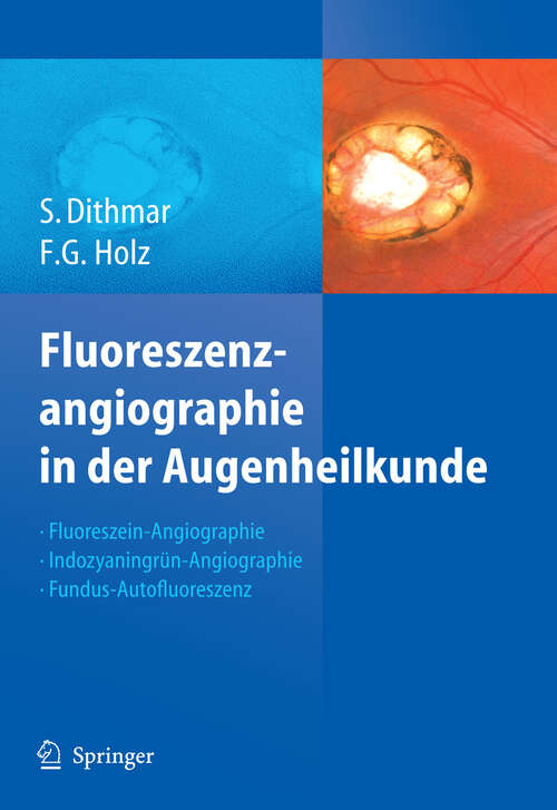 Book cover of Fluoreszenzangiographie in der Augenheilkunde: Fluoreszein-Angiographie, Indozyaningrün-Angiographie und Fundus-Autofluoreszenz (2008)