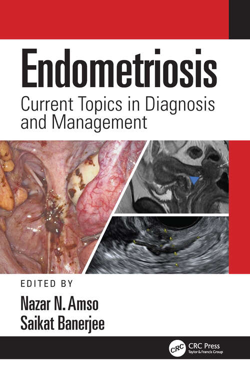 Book cover of Endometriosis: Current Topics in Diagnosis and Management