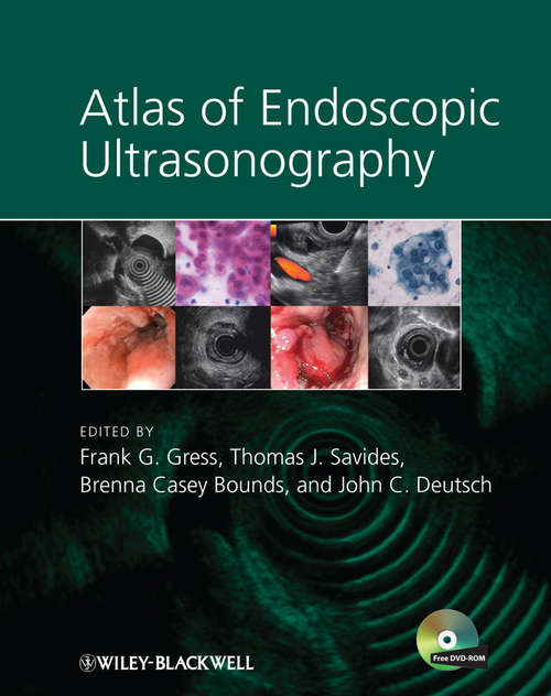 Book cover of Atlas of Endoscopic Ultrasonography