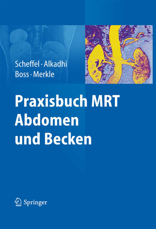 Book cover of Praxisbuch MRT Abdomen und Becken (2012)