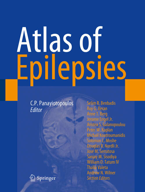 Book cover of Atlas Of Epilepsies
