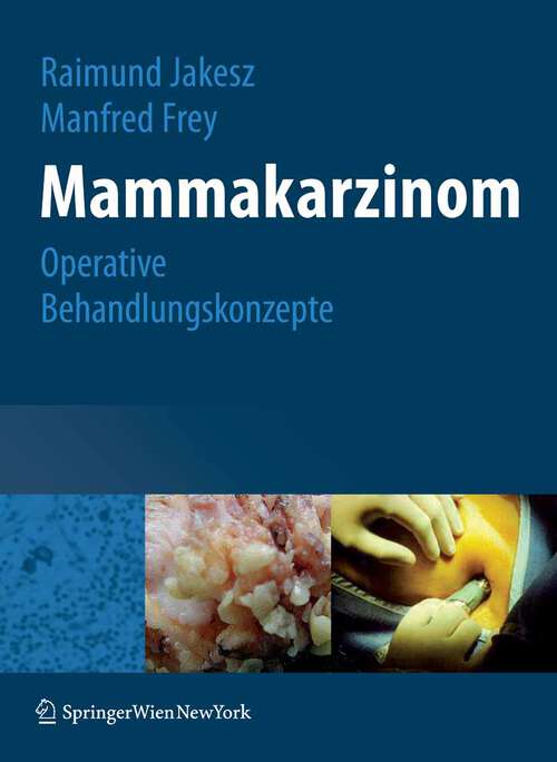 Book cover of Mammakarzinom: Operative Behandlungskonzepte (2007)
