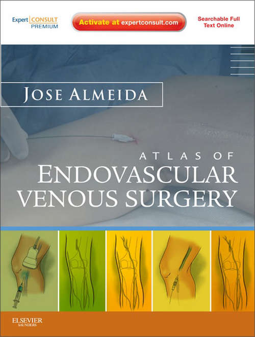 Book cover of Atlas of Endovascular Venous Surgery E-Book: Expert Consult - Online