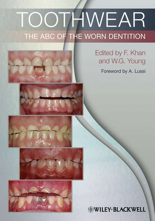 Book cover of Toothwear: The ABC of the Worn Dentition