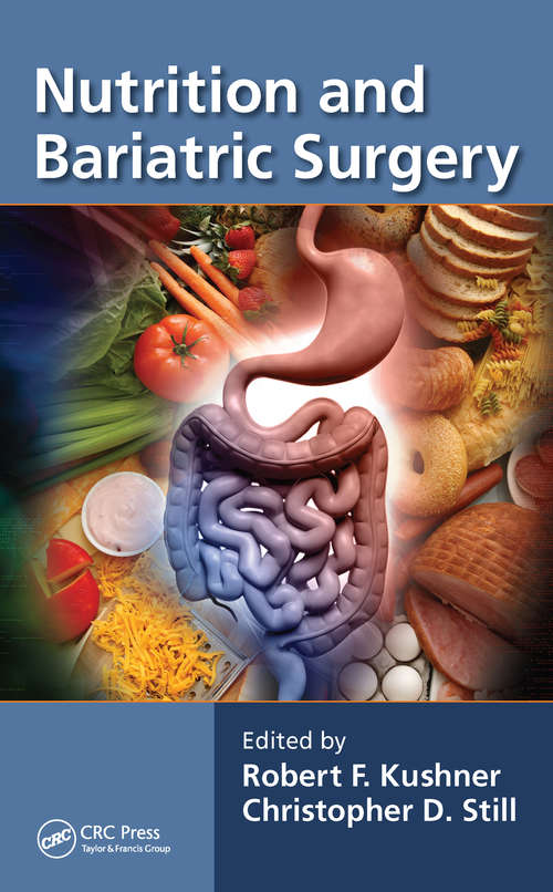 Book cover of Nutrition and Bariatric Surgery