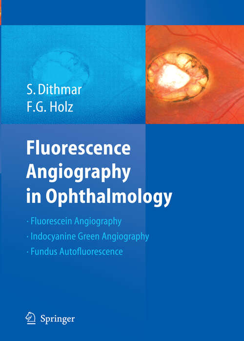 Book cover of Fluorescence Angiography in Ophthalmology (2008)
