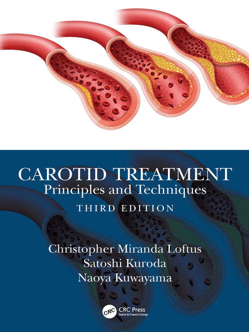 Book cover of Carotid Treatment: Principles and Techniques (3)