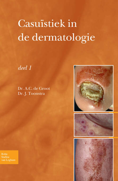 Book cover of Casuïstiek in de dermatologie - deel I (2009)