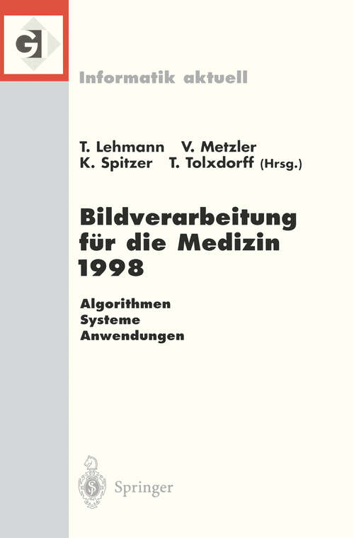 Book cover of Bildverarbeitung für die Medizin 1998: Algorithmen — Systeme — Anwendungen Proceedings des Workshops am 26. und 27. März 1998 in Aachen (1998) (Informatik aktuell)