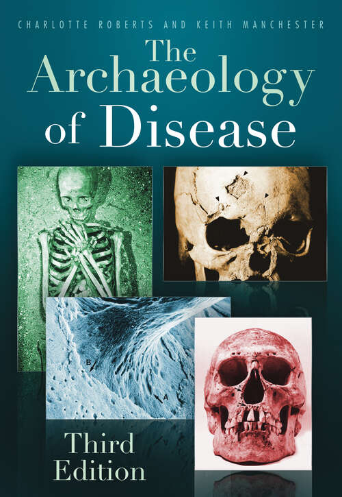 Book cover of The Archaeology of Disease: Third Edition (3) (Archaeology Ser.)