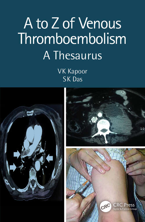 Book cover of A to Z of Venous Thromboembolism: A Thesaurus (2)