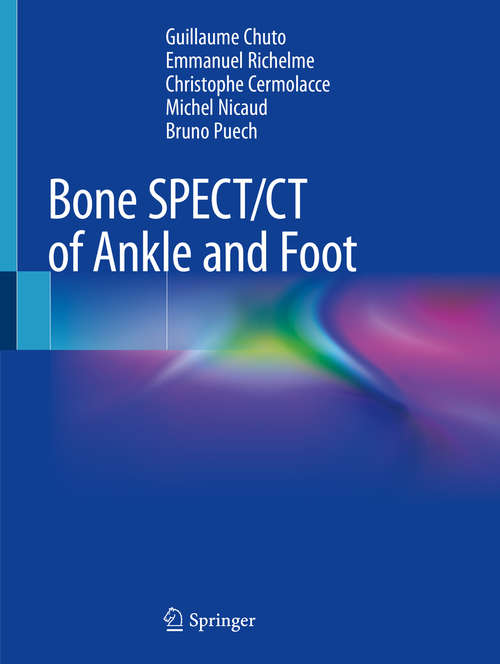 Book cover of Bone SPECT/CT of Ankle and Foot