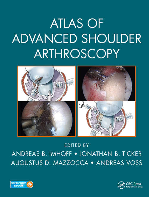 Book cover of Atlas of Advanced Shoulder Arthroscopy