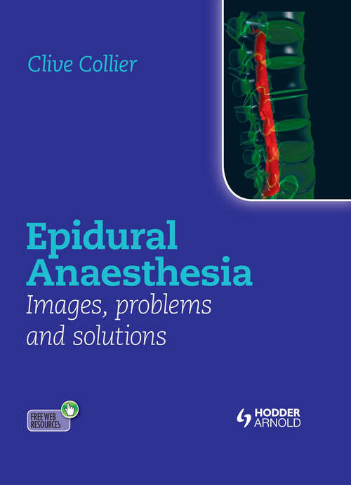 Book cover of Epidural Anaesthesia: Images, Problems and Solutions