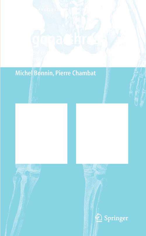 Book cover of La gonarthrose: Traitement chirurgical: de l´arthroscopie à la prothèse (2003) (Approche pratique en orthopédie-traumatologie)