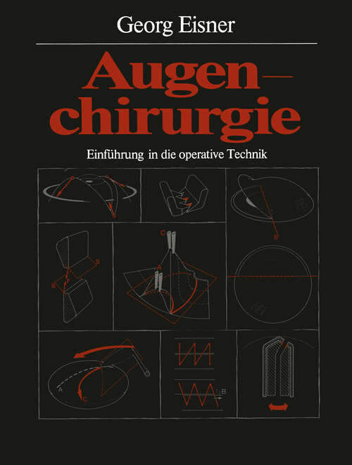 Book cover of Augenchirurgie: Einführung in die operative Technik (1978)